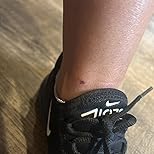 Customer Image, click to open customer review